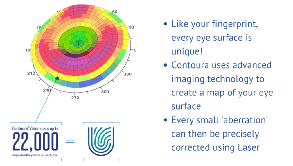 contoura vision maps 22000 unique points